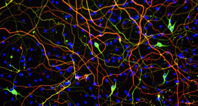 A microscope image of a network of brain cells. The brain cells are long and branching, and are coloured to glow green, red and blue.